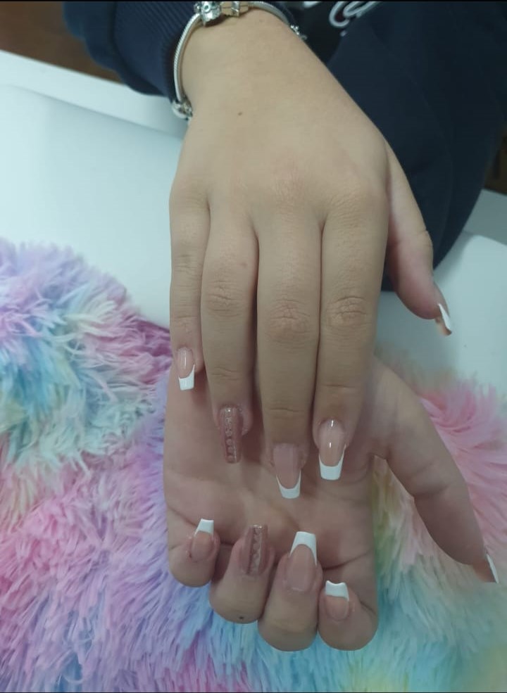 fig-nails