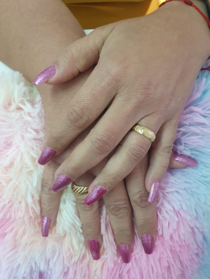 fig-nails